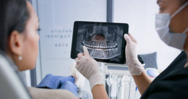 Licensed Tooth Extraction service in San Carlos, TX - Smile Center Dentistry